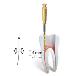 Ace Preevazare Coronara T-Wire | Micromega Coltene