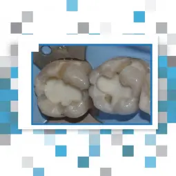 TheraBase 8g