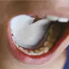 DryDent sublingual absorbant pads