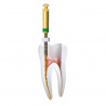 Ace rotative inteligente C-Wire | Ace rotativeMicromega Coltene