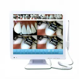 Caméra intra-oral M-978V Plus + moniteur 17" avec écran tactile