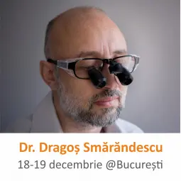 SGPS - Scan, Guide, Prep, Scan. Un itinerar detaliat în etapele proteticii fixe