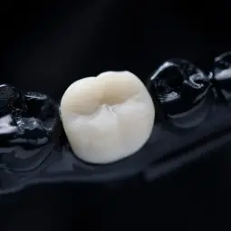 Ceramic Crown SprintRay 250g resin