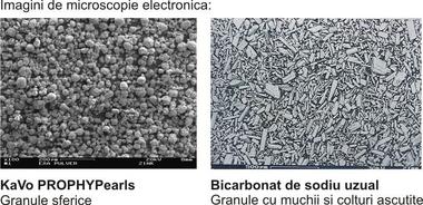 perle-vs-bicarbonat.jpg
