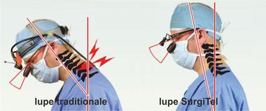 lupe-surgitel-ergonomie.jpg