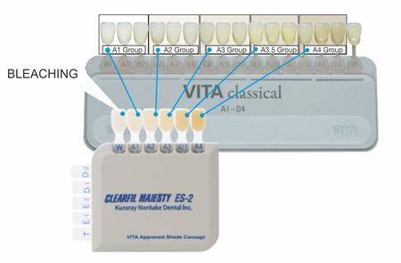 clearfil-majesty-es-cheie.jpg