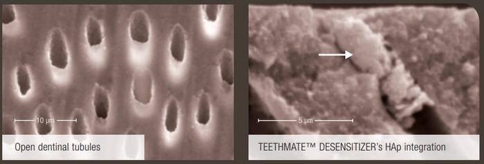 teethmate-desensitizer-sem.jpg