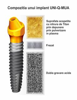 implant-uni-compozitie.jpg