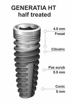 implant-dentar-ik-38-half.jpg