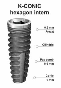 implant-dentar-ik-38.jpg