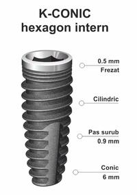 implant-dentar-ik-42.jpg