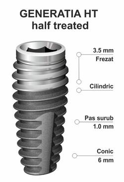 implant-dentar-ik-46-ht.jpg