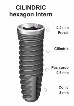 implant-ic-30.jpg