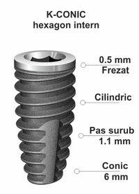 implant-dentar-ik-50.jpg