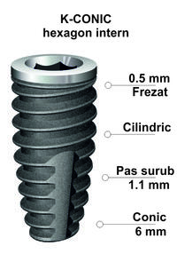 implant-dentar-ik-50.jpg