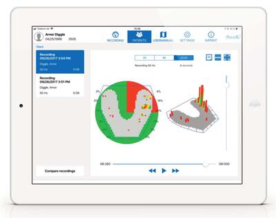 occlusense-aplicatie-ipad.jpg